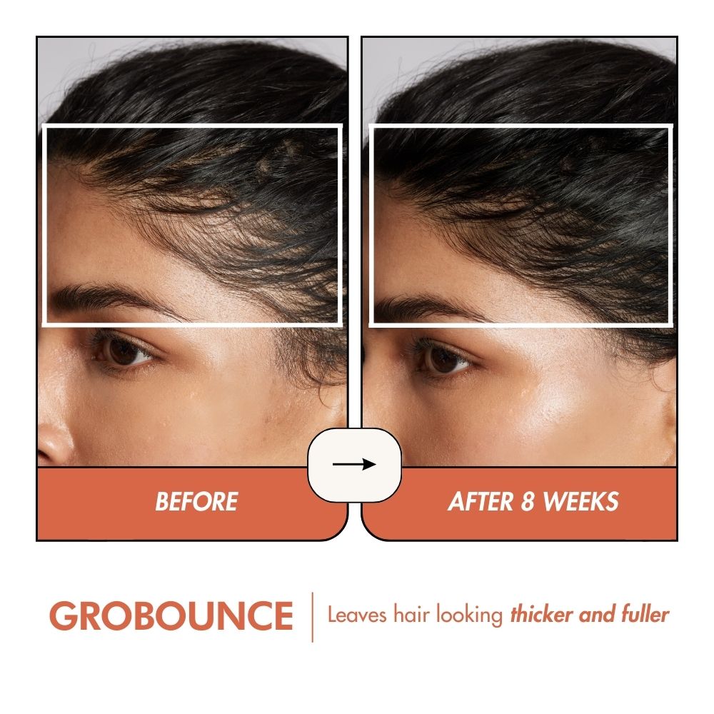 THE GROBOUNCE 4-in-1 Hair Volumiser