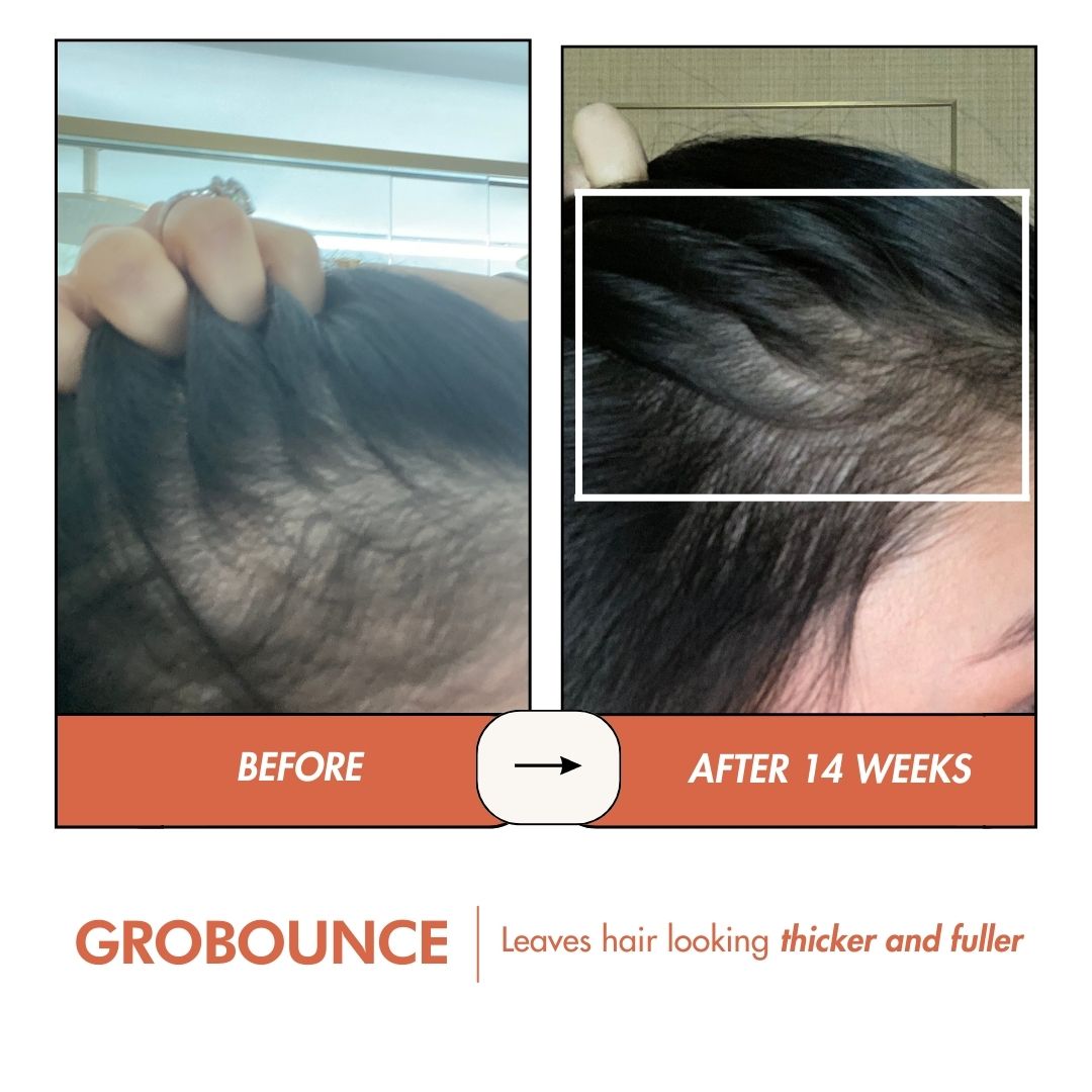 THE GROBOUNCE 4-in-1 Hair Volumiser